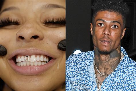 Blueface Signs Woman Who Chipped Her Tooth During Fight In。